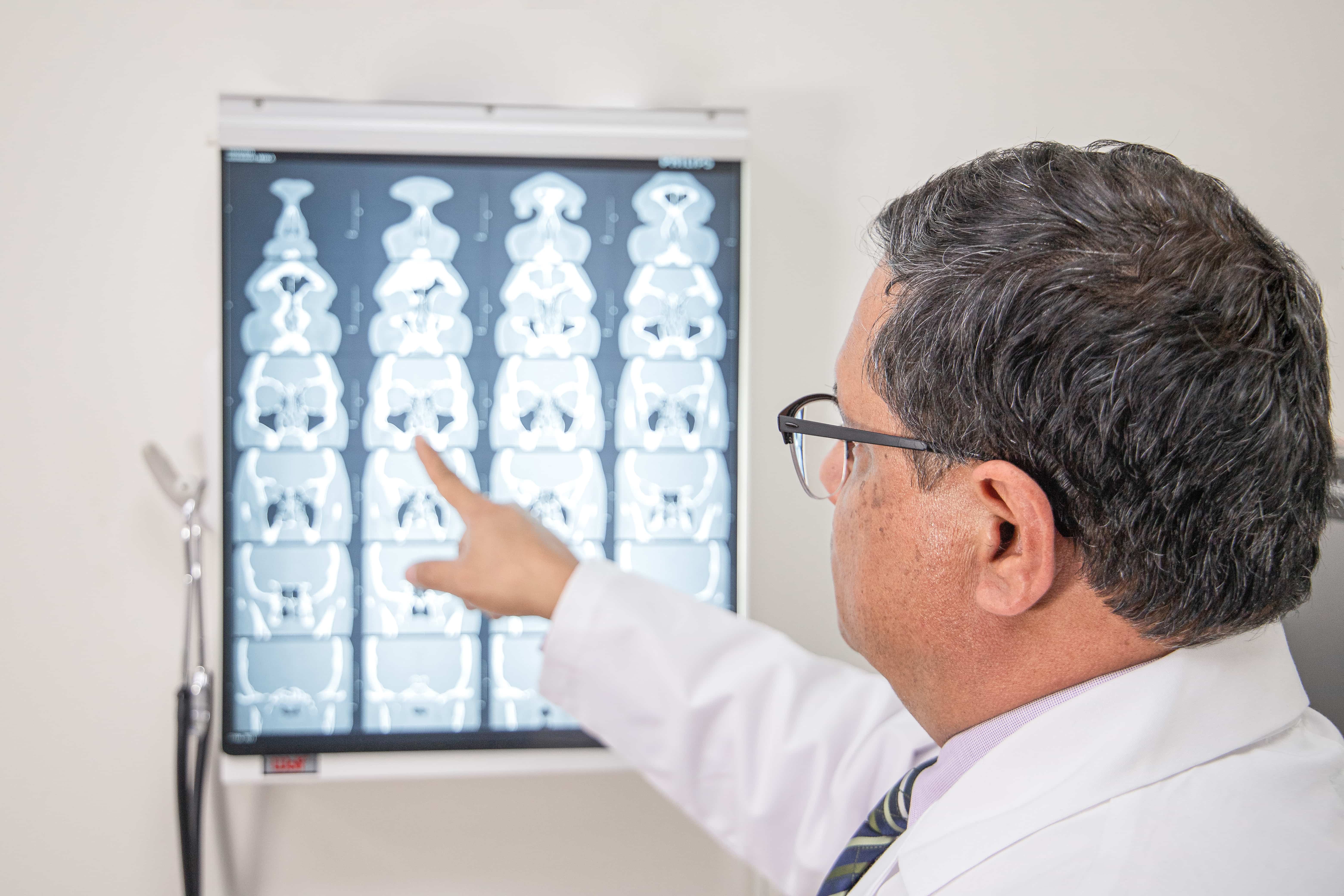 Servicios que ofrece el otorrinolaringólogo Carlo Pedroza